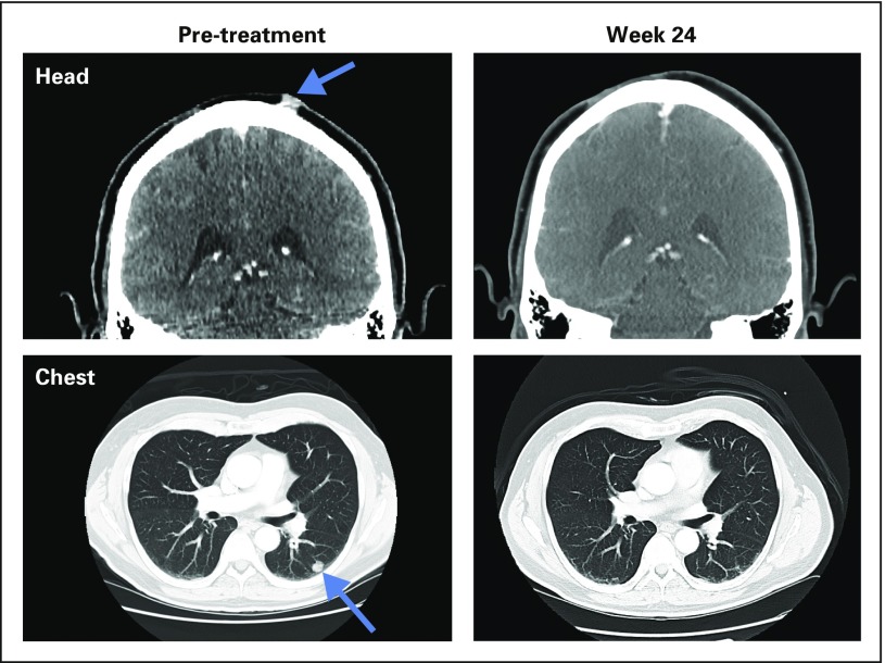 Fig A2.