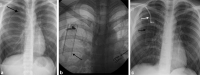 Fig. 9