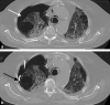 Fig. 10