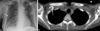 Fig. 12