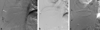 Fig. 11