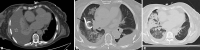 Fig. 13