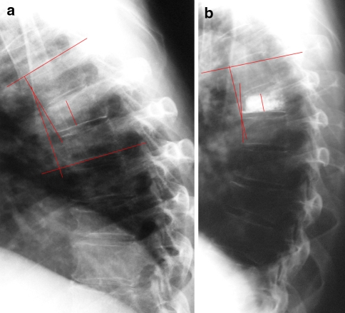 Fig. 4