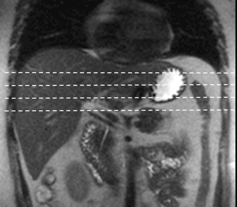 Fig.3.