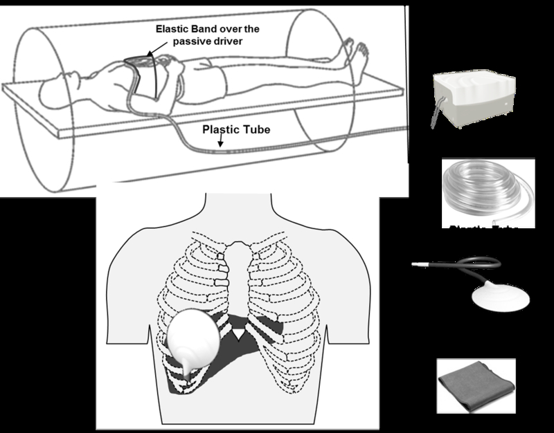 Fig.1.