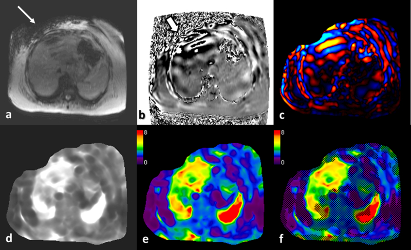 Fig.4.