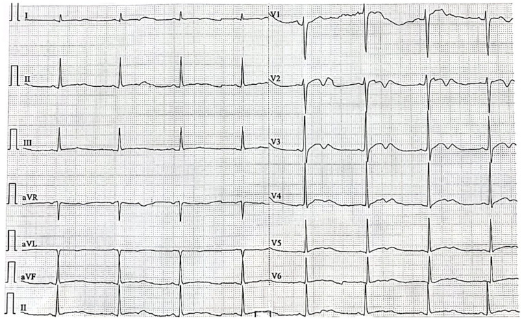 Figure 1.