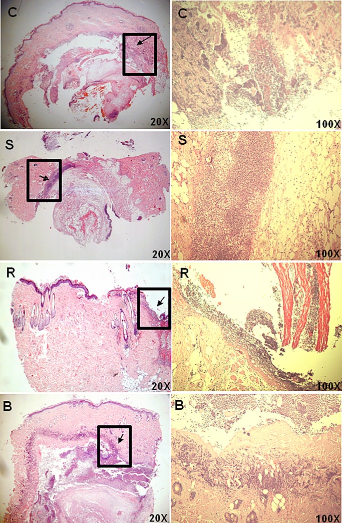 Fig 11