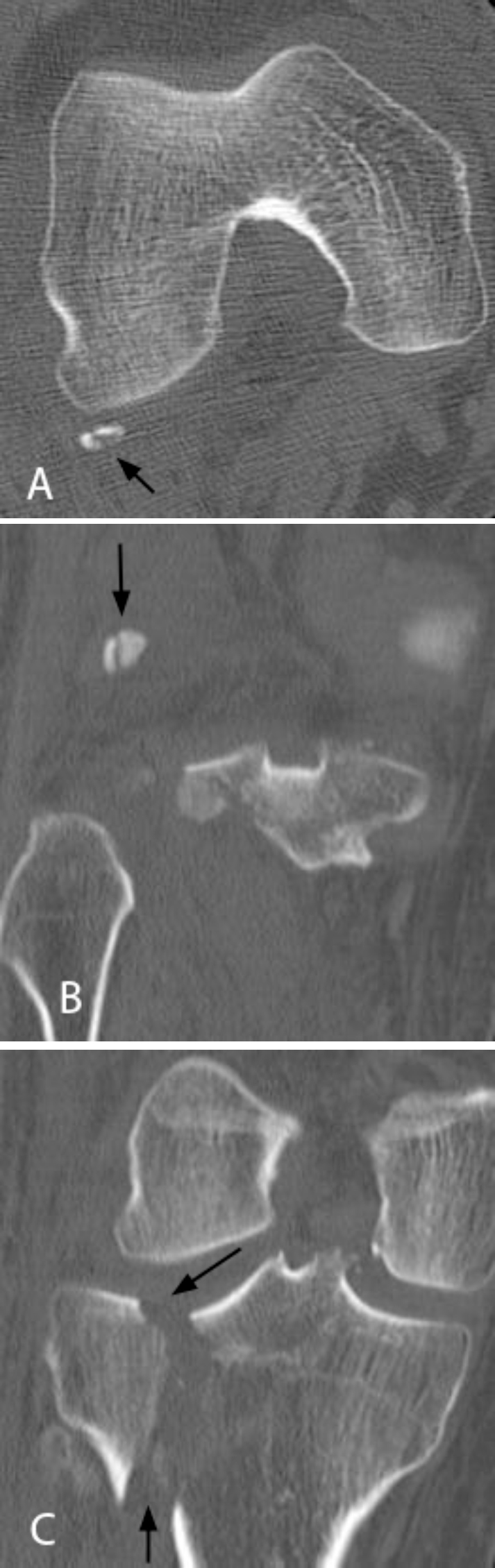 Fig. 2A, B, C