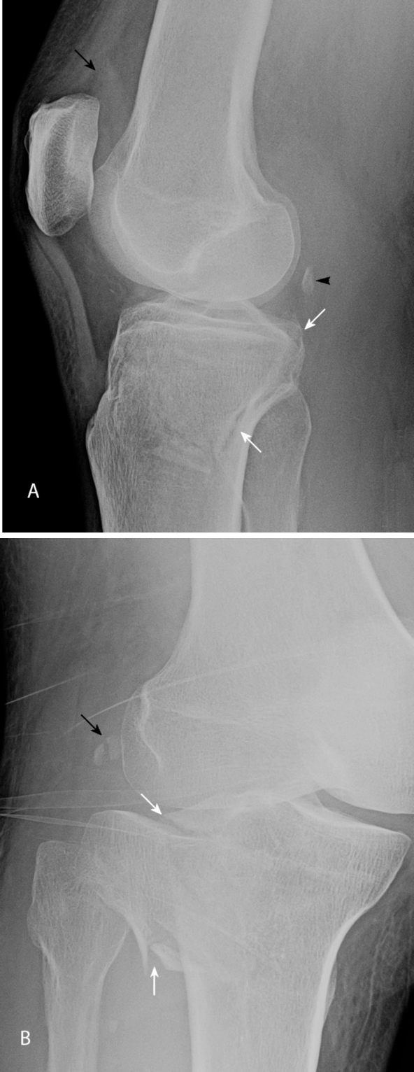 Fig. 1A & B