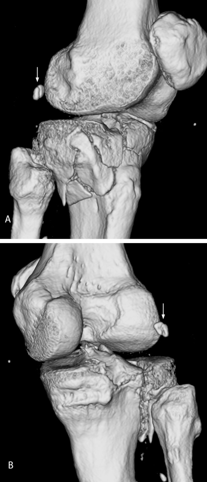 Fig. 3A, B