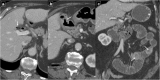 Fig. 20