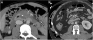Fig. 21