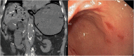 Fig. 23