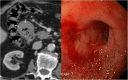 Fig. 11