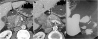 Fig. 16