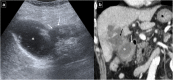 Fig. 19