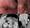 Fig. 18
