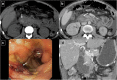 Fig. 22