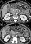 Fig. 13