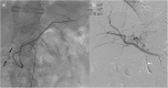 Fig. 12
