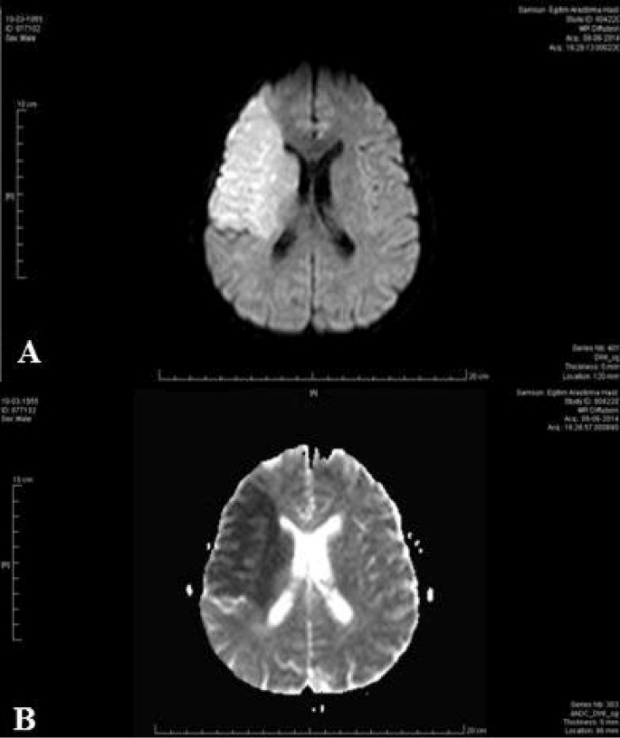 Fig. 2