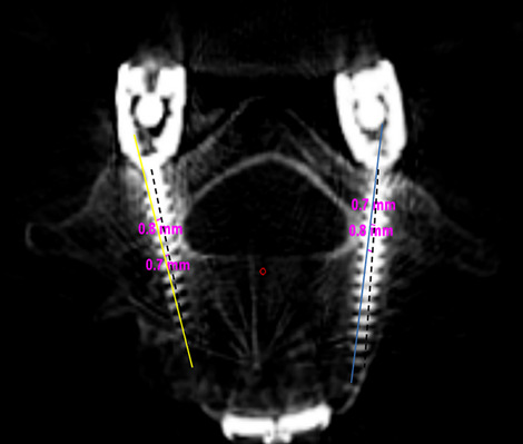 Fig. 10