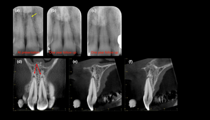 FIGURE 11