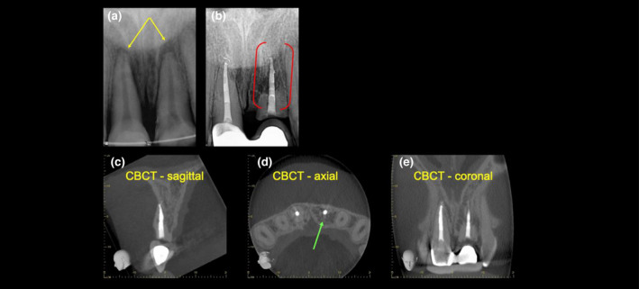 FIGURE 10