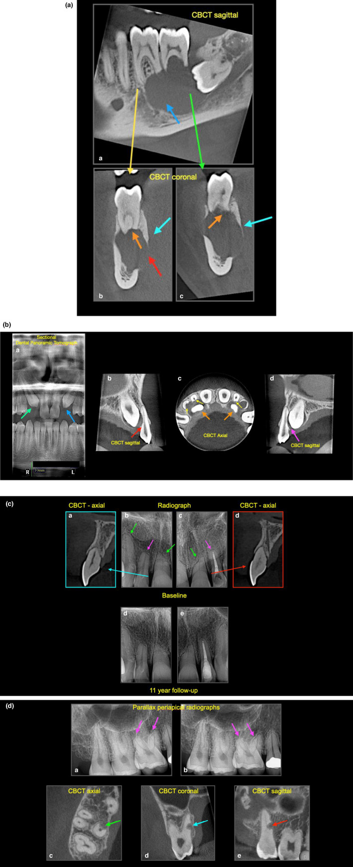 FIGURE 4