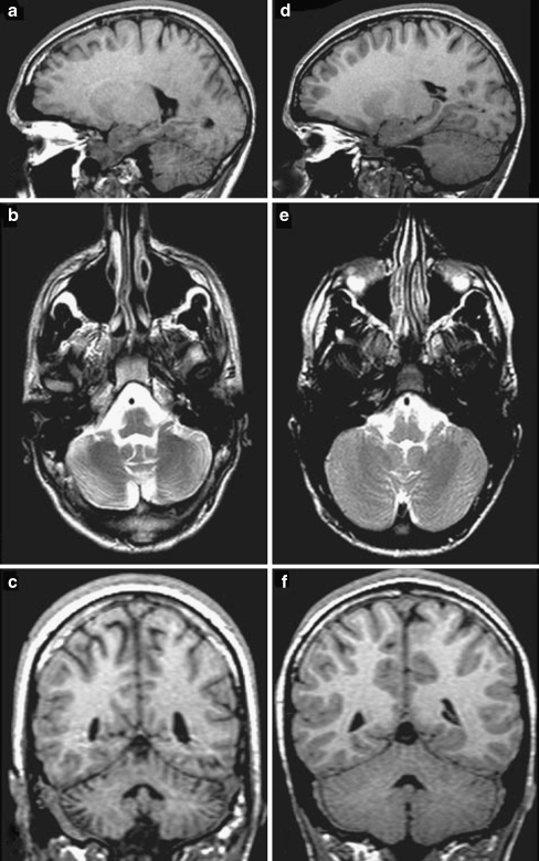 Fig. 1.