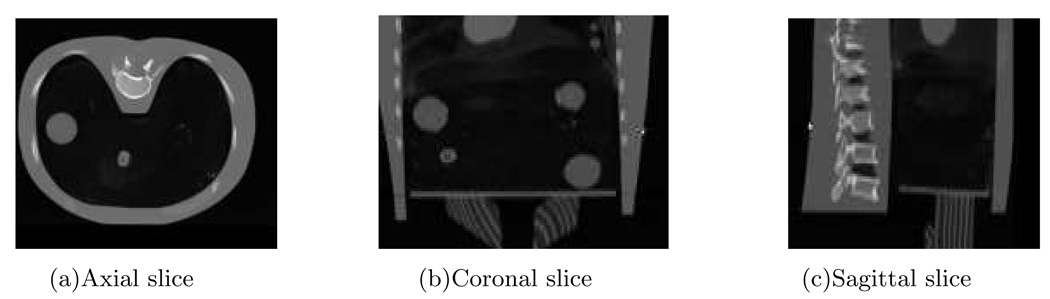 FIG. 14