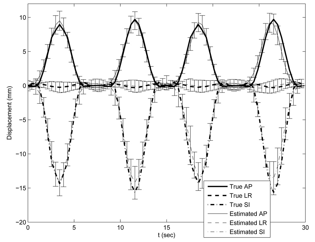 FIG. 11