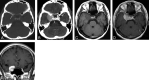 Fig 2.