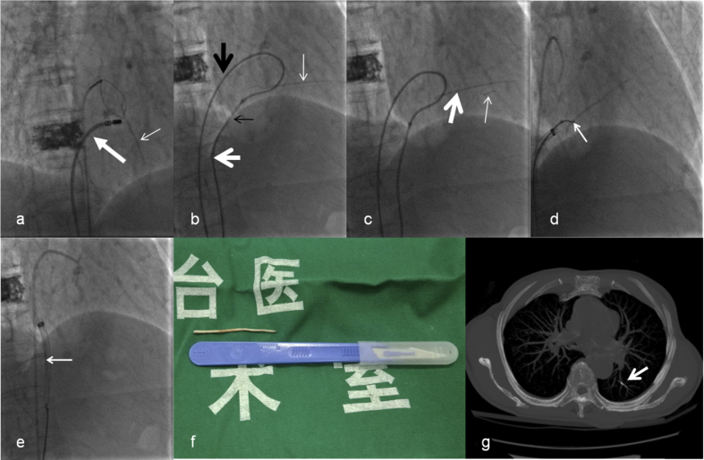 Fig. 2