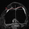 Figure 3b: