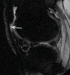 Figure 4b: