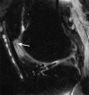 Figure 4d: