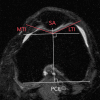 Figure 3a: