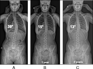 Fig. 20