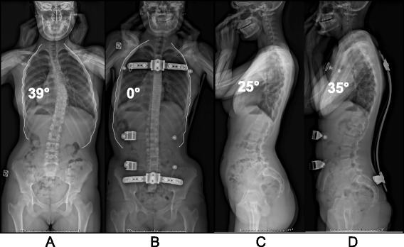 Fig. 19