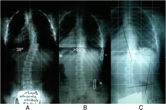 Fig. 61