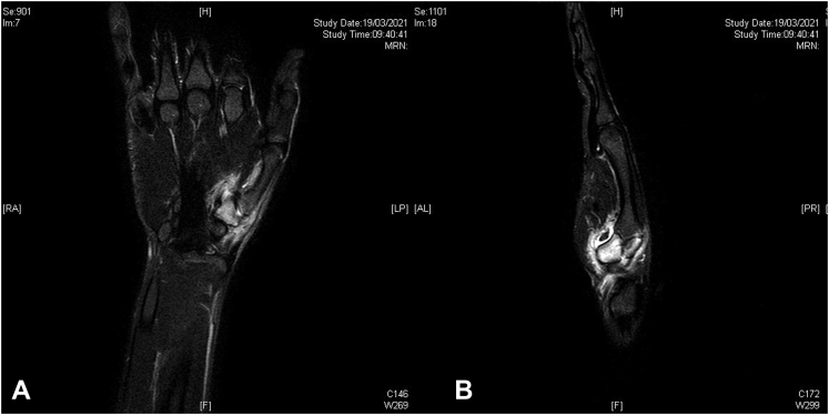 Figure 2
