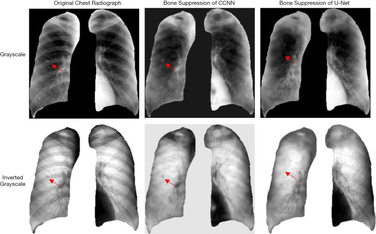 Figure 10