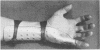 295