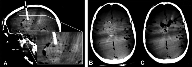 Figure 3