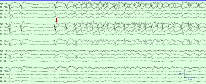 Figure 4