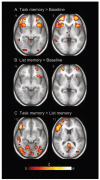 FIG. 3