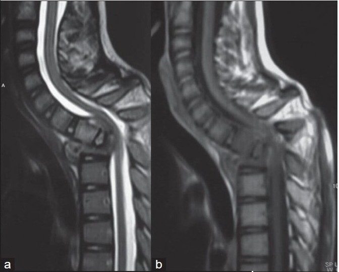 Figure 6B