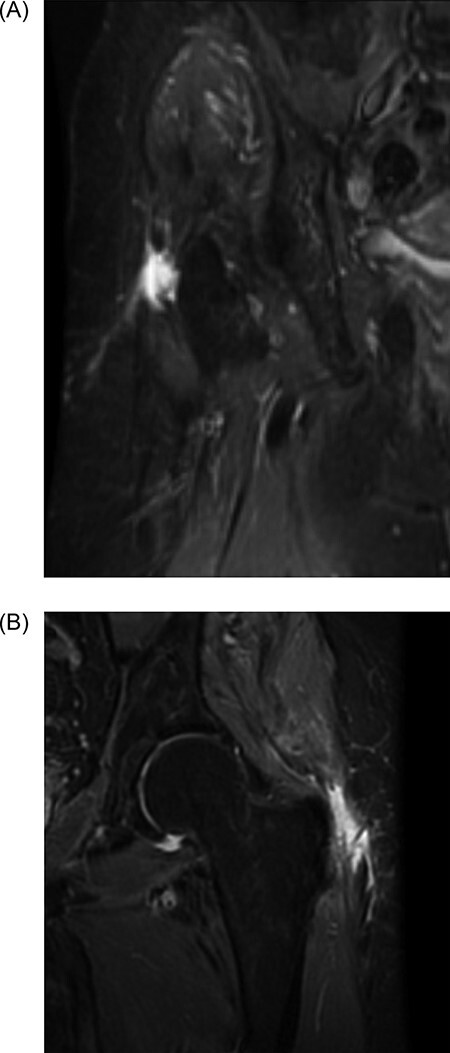 Fig. 2.